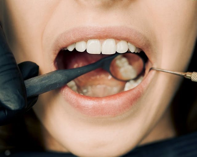 Oral Health and Stroke: The Hidden Connection You Need to Know