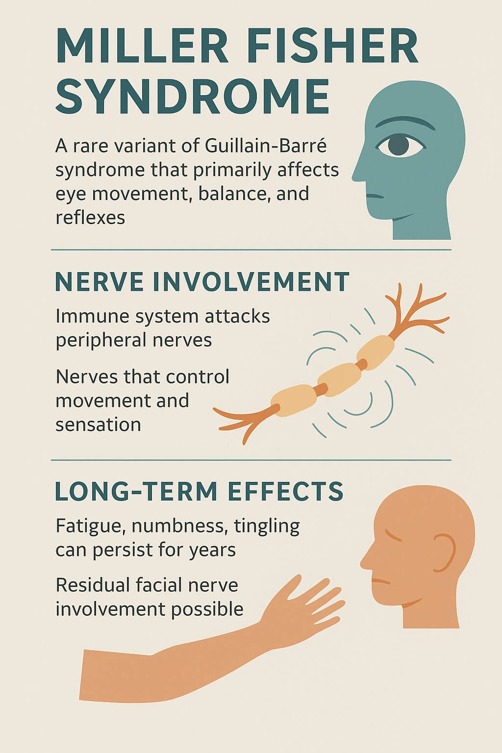 Infographic summarizing Miller Fisher syndrome with sections on symptoms affecting eye movement and balance, nerve involvement from immune attack, and long-term effects like fatigue or tingling.
